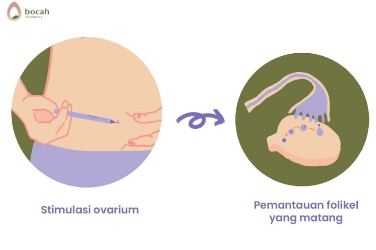 proses inseminasi buatan stimulasi ovarium dan pemantauan waktu ovulasi