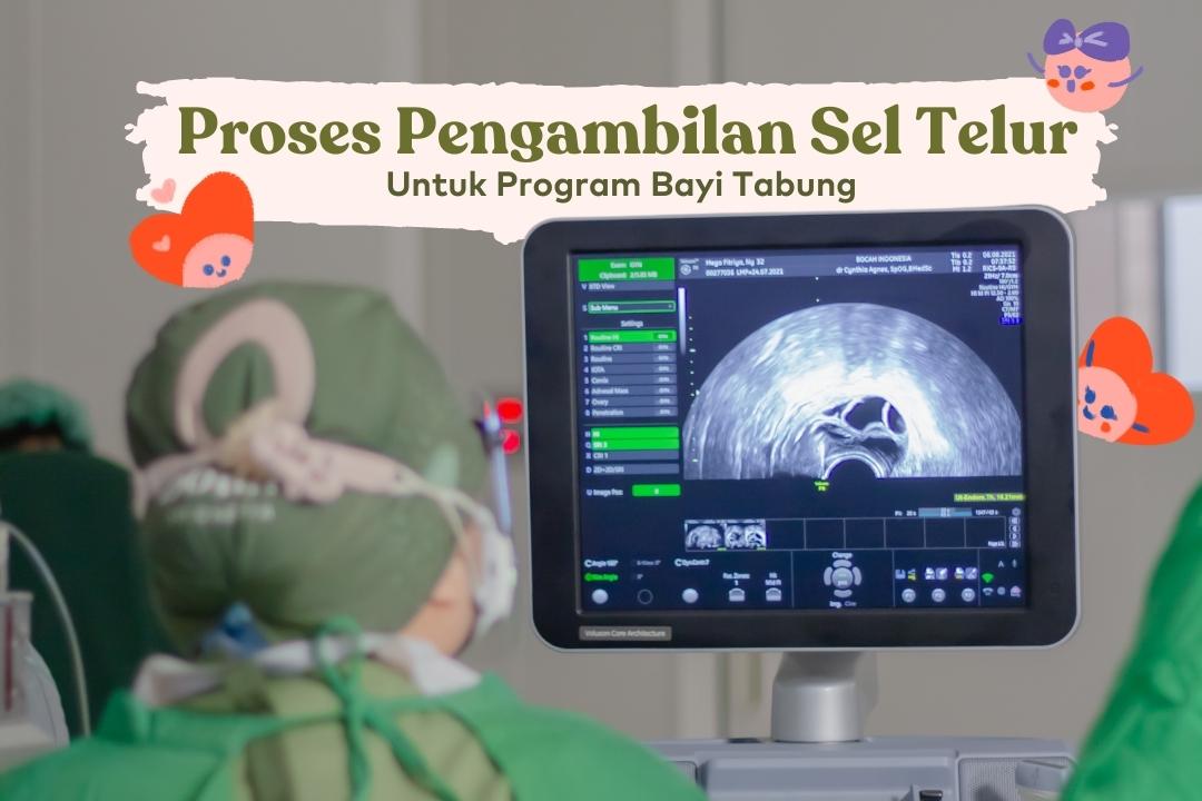 Proses pengambilan sel telur untuk bayi tabung