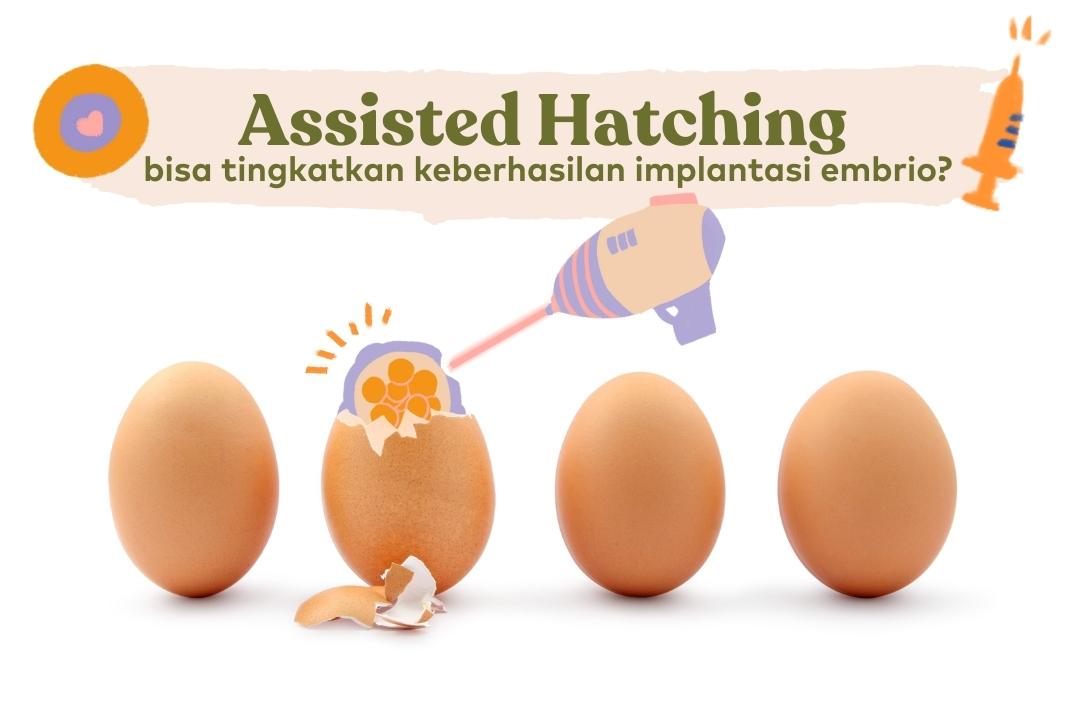 assisted hatching untuk implantasi embrio