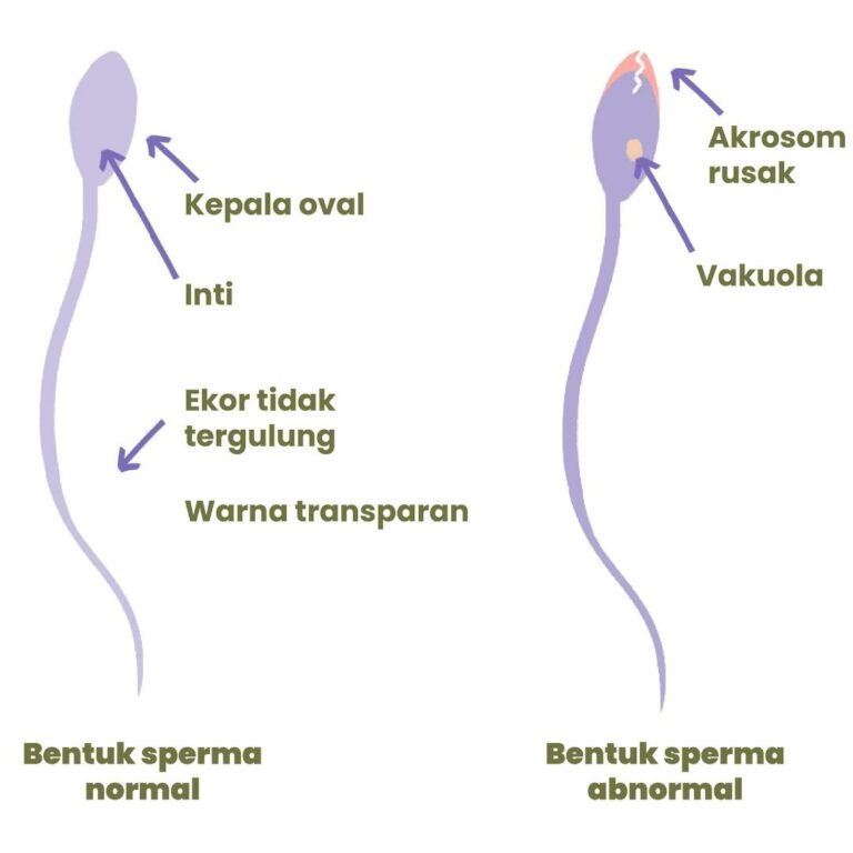 perbandingan bentuk sperma normal dan abnormal