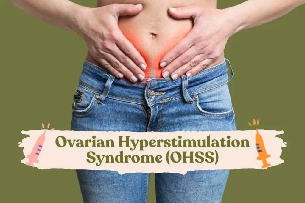 ovarian-hyperstimulation-syndrome-ohss