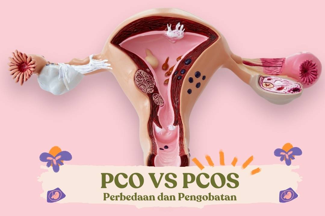 perbedaan PCO dan PCOS