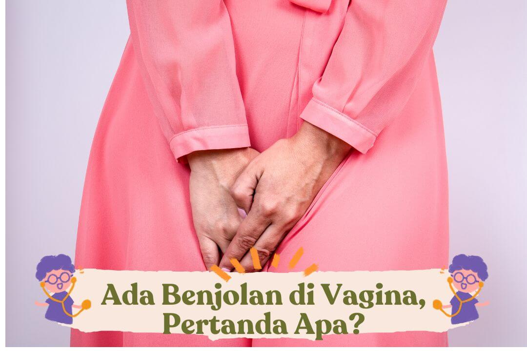 benjolan-di-vagina