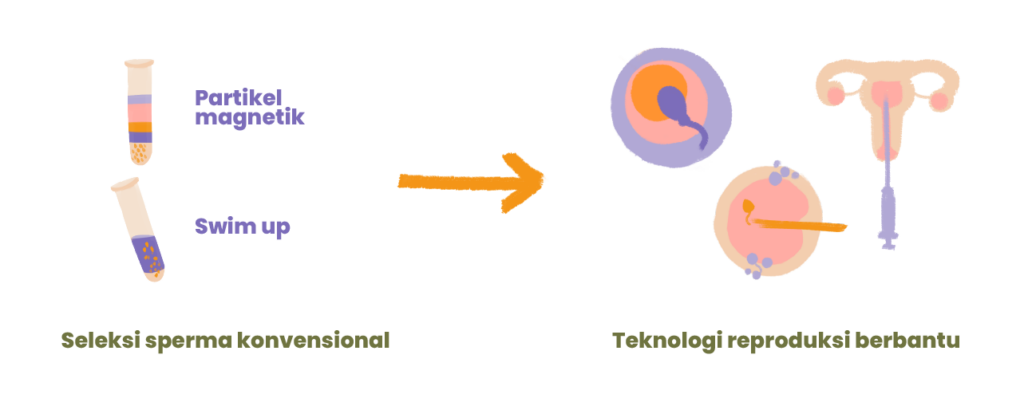 Seleksi sperma konvensional dan teknologi reproduksi terbantu