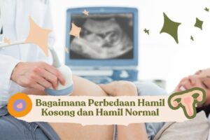 Bagaimana Perbedaan Hamil Kosong dan Hamil Normal