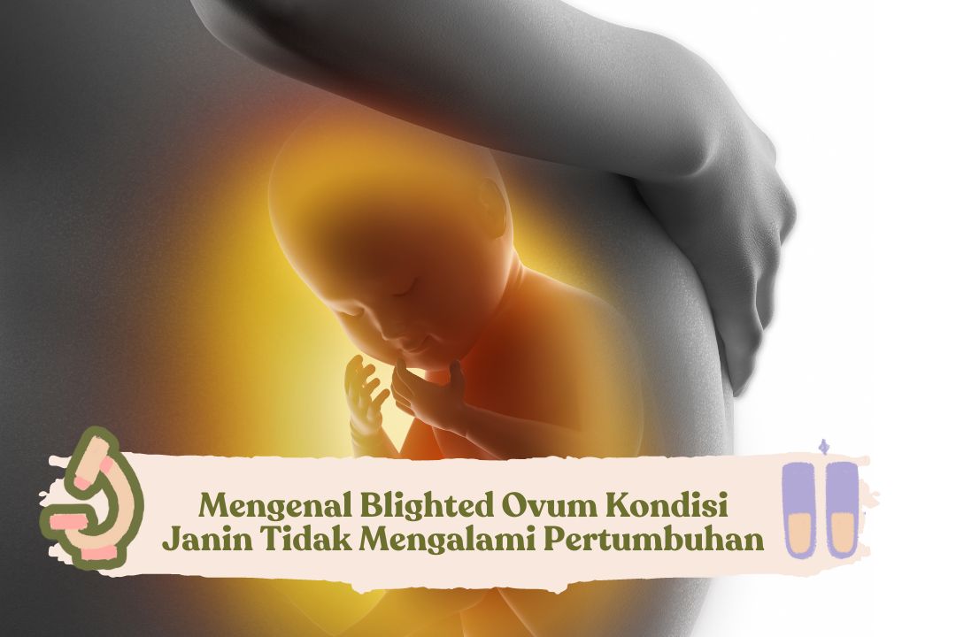 Mengenal Blighted Ovum Kondisi Janin Tidak Mengalami Pertumbuhan