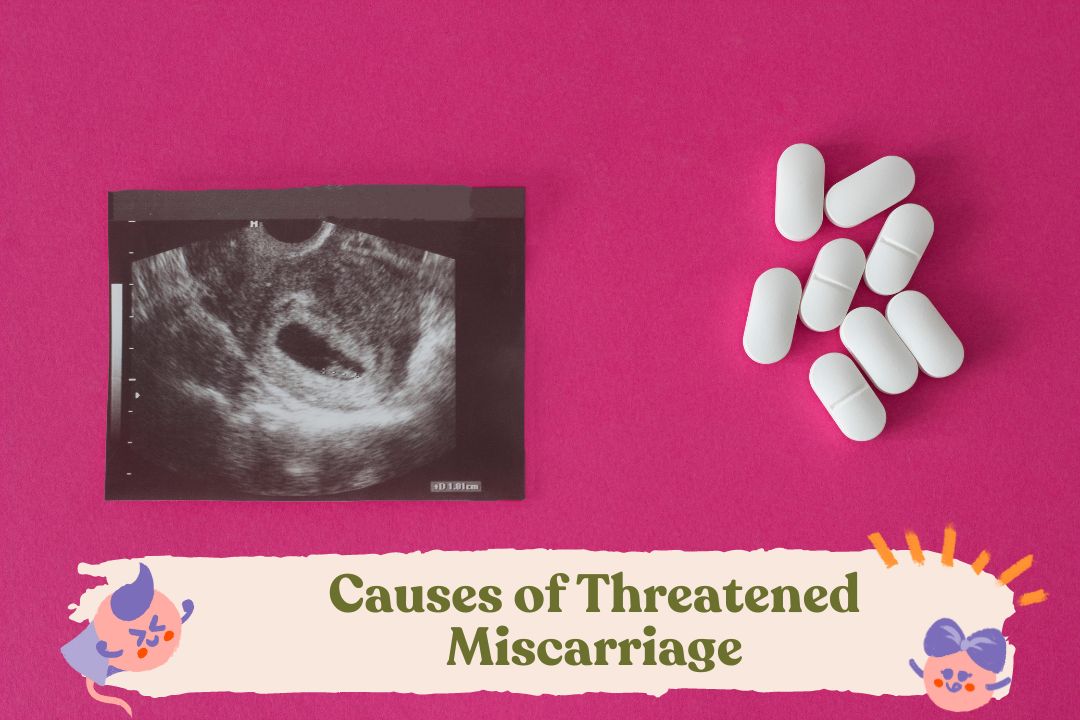 Causes of Threatened Miscarriage