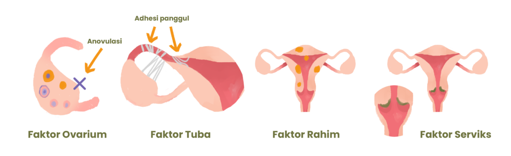 Kerusakan pada tuba falopii