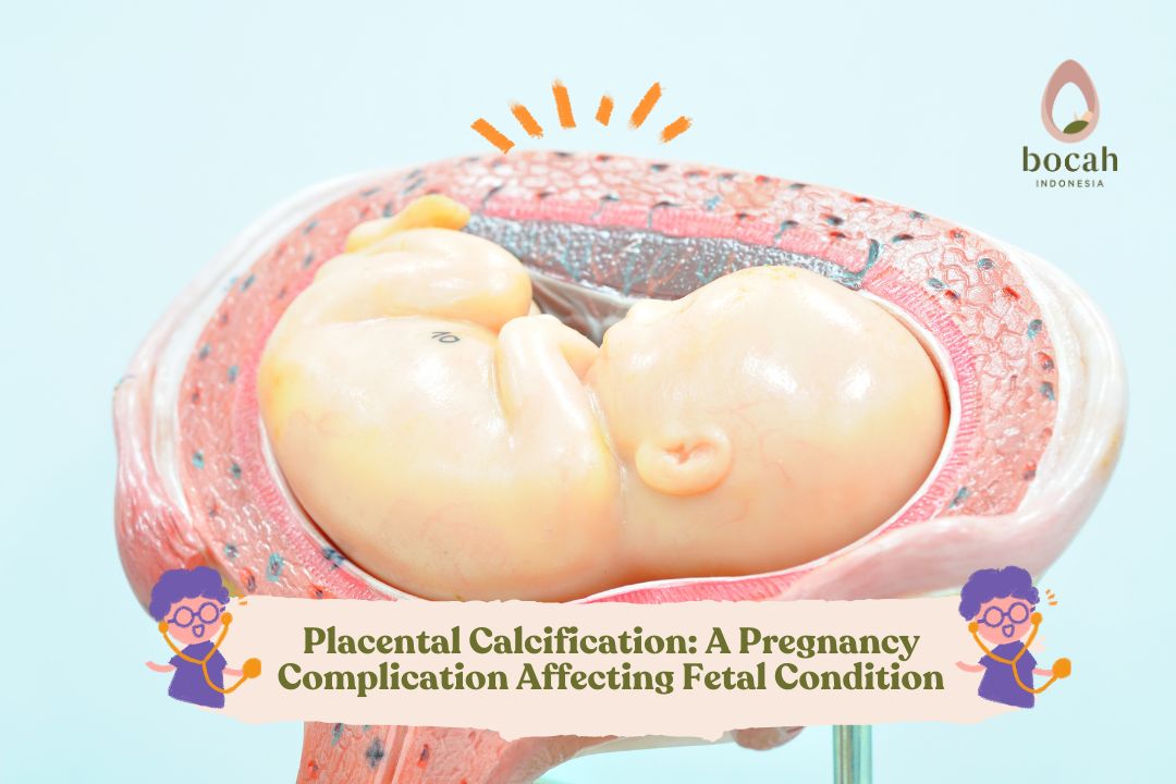 Placental Calcification A Pregnancy Complication Affecting Fetal Condition