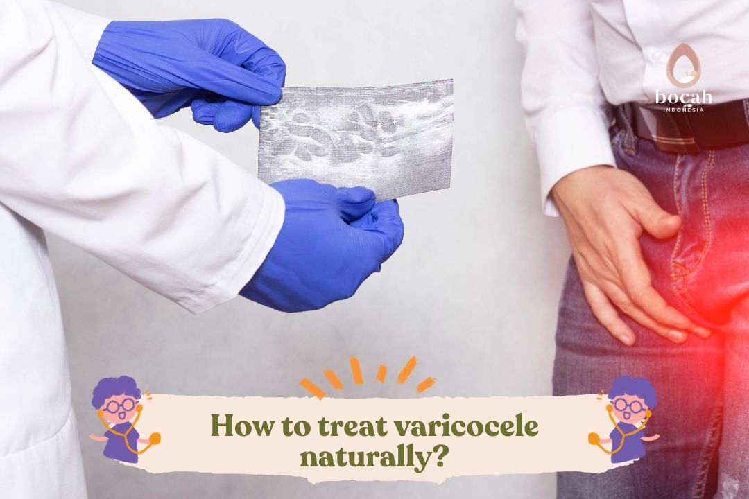 How to treat varicocele naturally