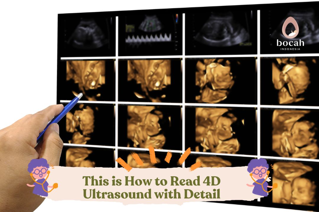 This is How to Read 4D Ultrasound with Detail