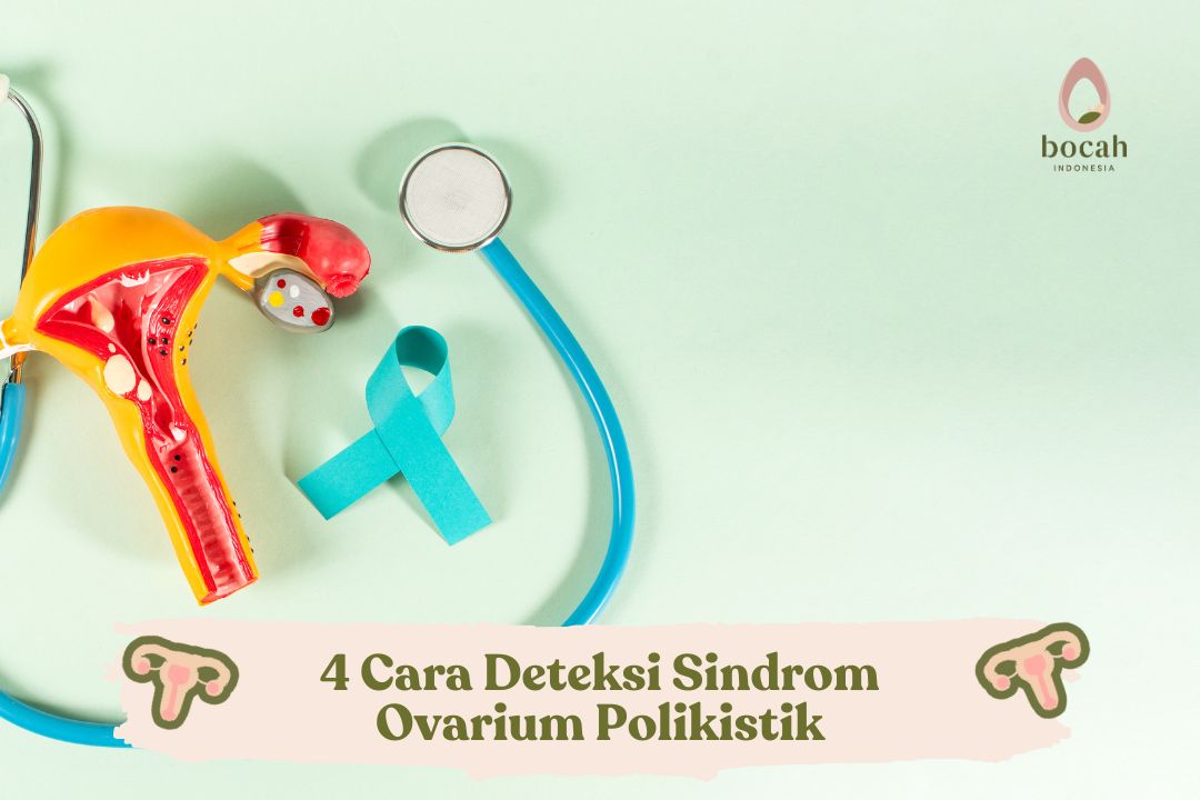 4 Cara Deteksi Sindrom Ovarium Polikistik