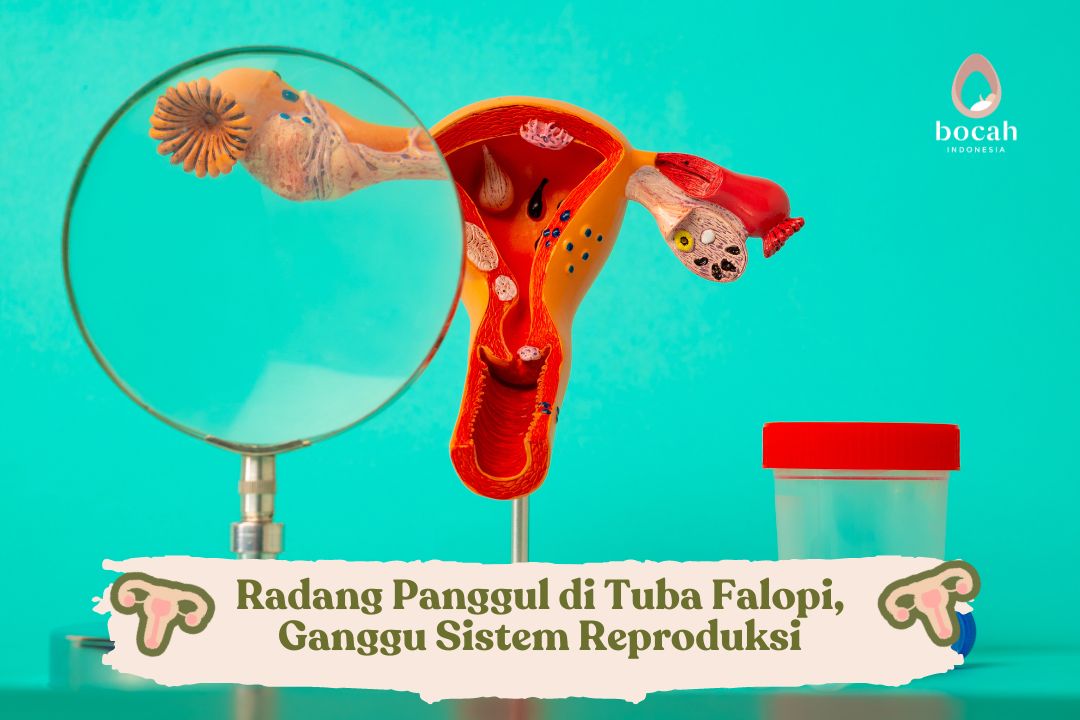 Radang Panggul di Tuba Falopi, Ganggu Sistem Reproduksi