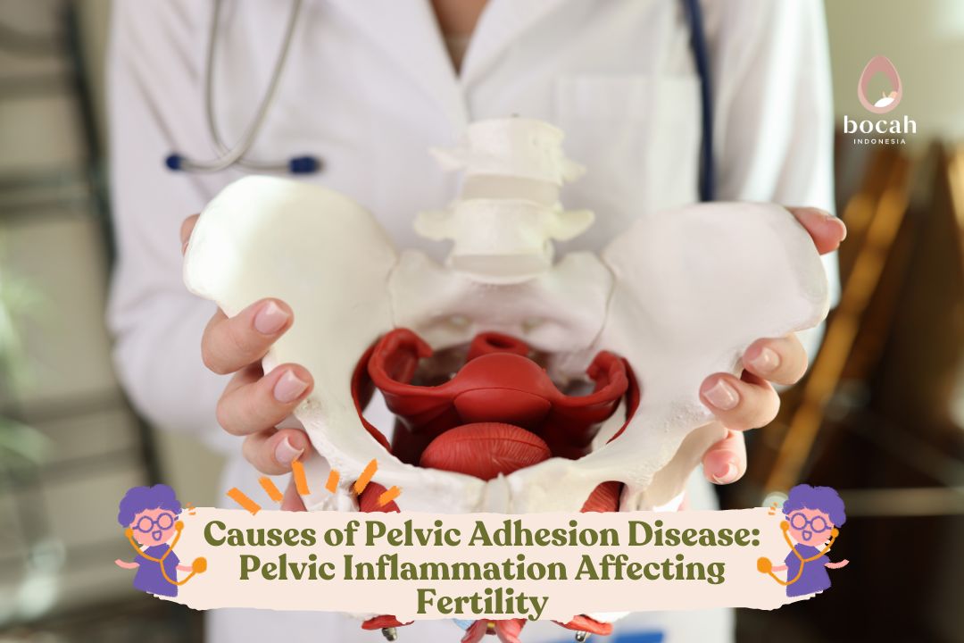 Causes of Pelvic Adhesion Disease Pelvic Inflammation Affecting Fertility