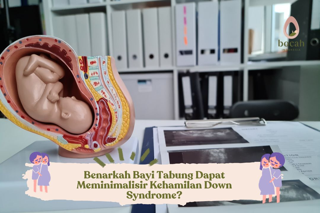 Benarkah Bayi Tabung Dapat Meminimalisir Kehamilan Down Syndrome